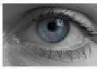 Lesiones oculares | Recurso educativo 81470