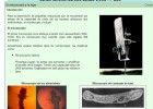 El microscopio y la lupa binocular | Recurso educativo 678406